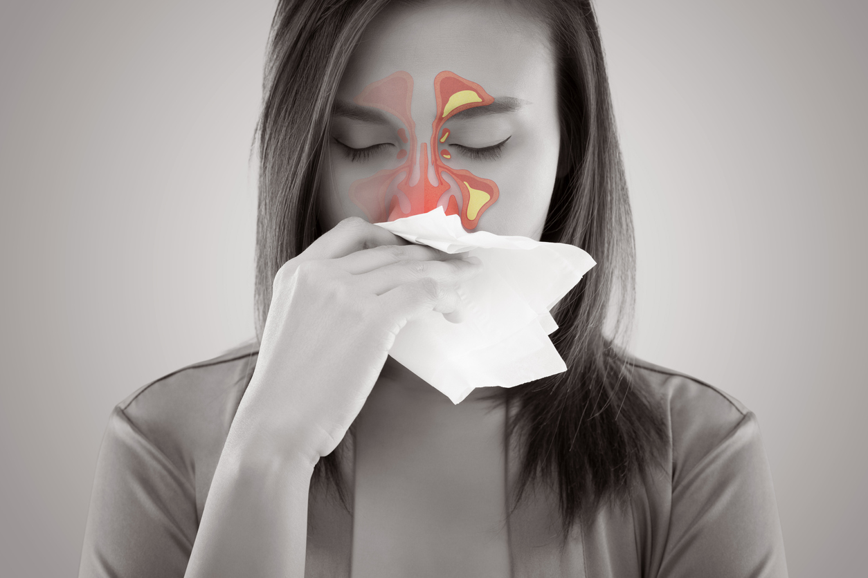 Sinus Infection (Sinusitis): Causes & Symptoms
